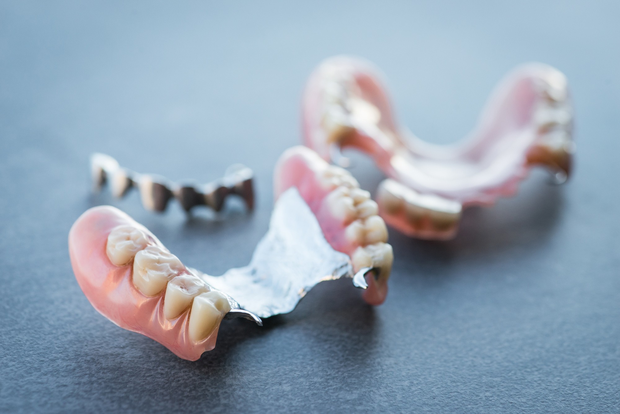 Artificial replacement teeth on a dark table